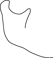 Polygon