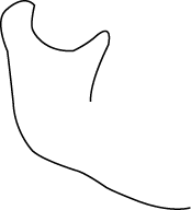 Polygon