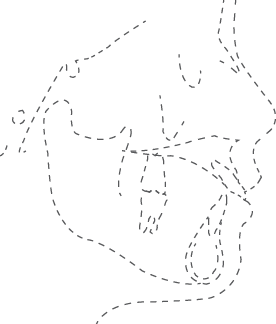 Polygon