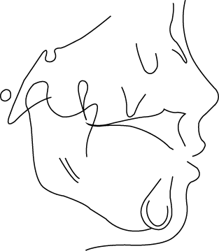 Polygon