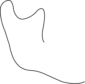 Polygon