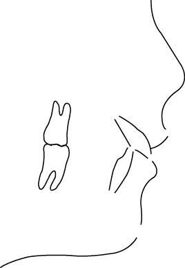 Polygon