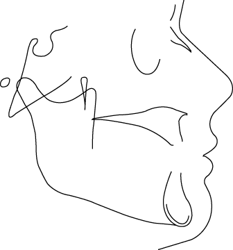 Polygon