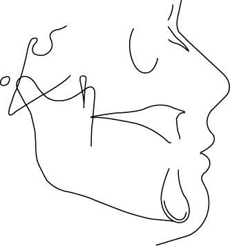 Polygon
