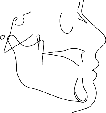Polygon