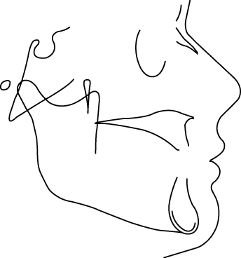 Polygon