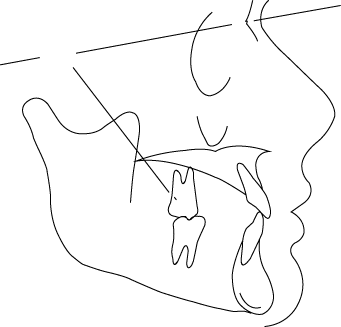 Polygon