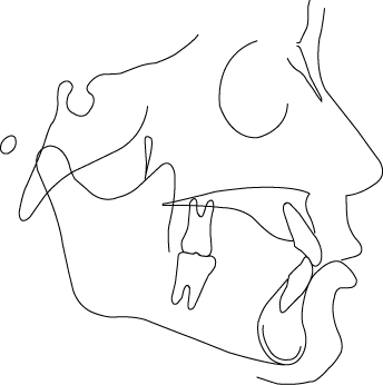 Polygon