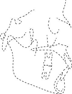 Polygon