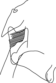 Polygon