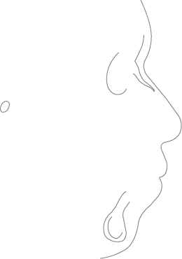 Polygon
